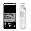 The HAN-05 USB HD Scalp Detector