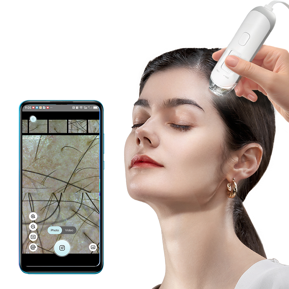 The HAN-05 USB HD Scalp Detector