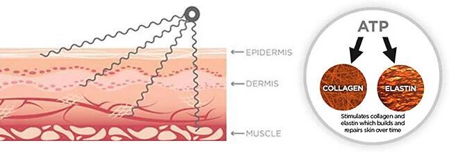 Microcurrent