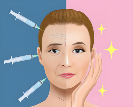 Botox.jpeg
