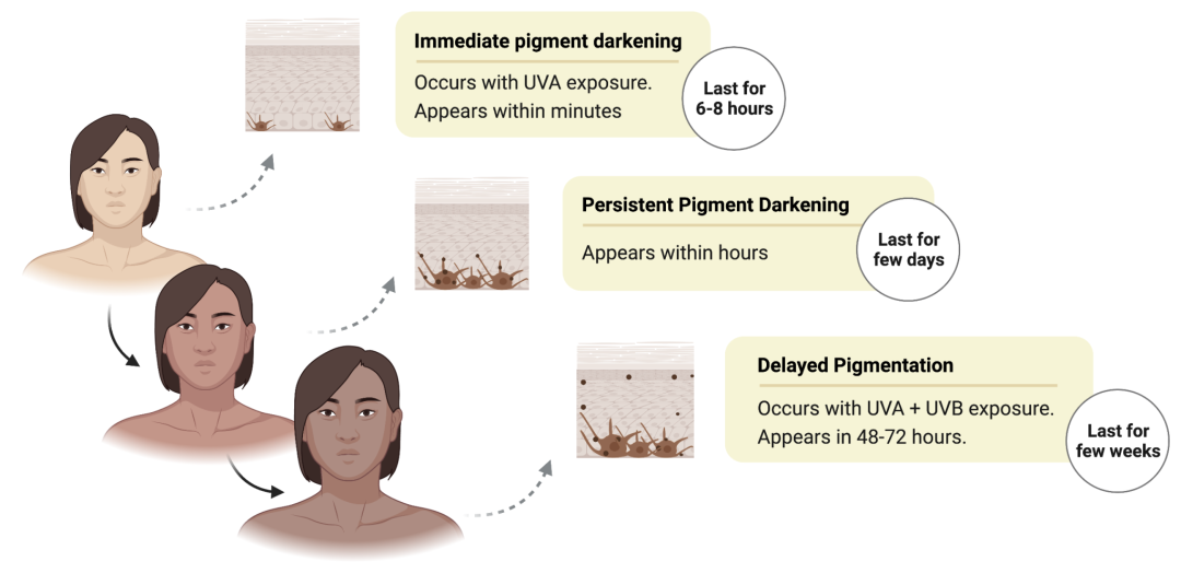 How to Reverse Sun-Induced Dark Spots? Block Melanin Production Effectively