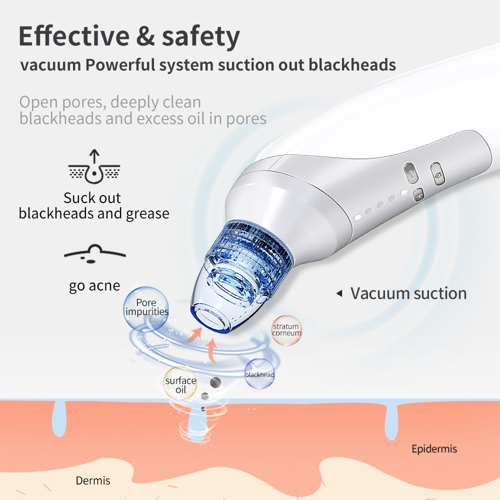 enm876 blackhead remover (2)