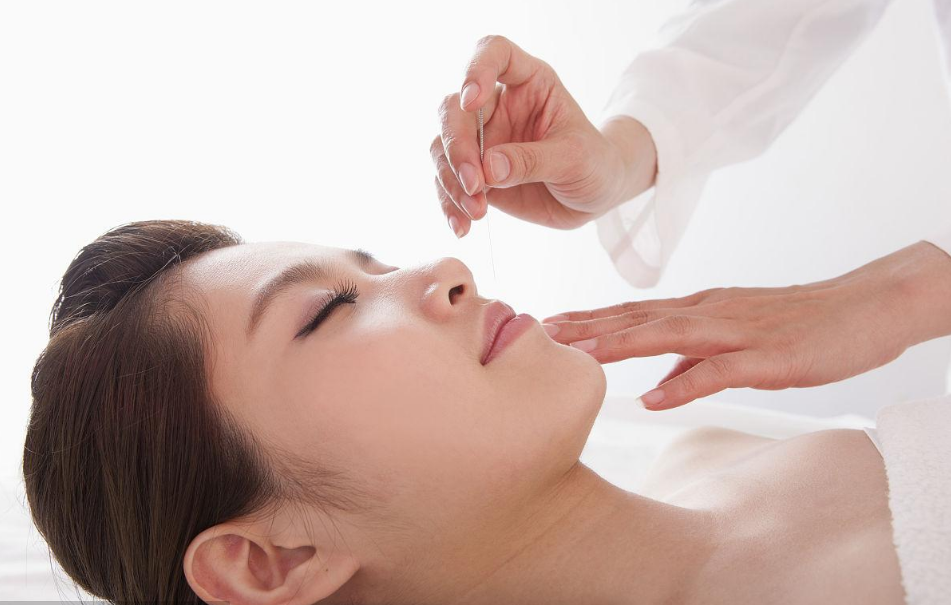 Facial Acupuncture Beauty: Ancient Chinese Wisdom Meets Modern Aesthetics