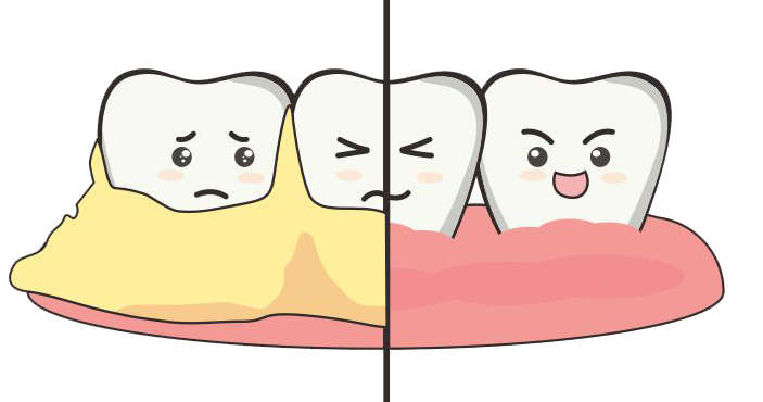 Is Teeth Cleaning Good Or Bad? The Truth About Dental Scaling