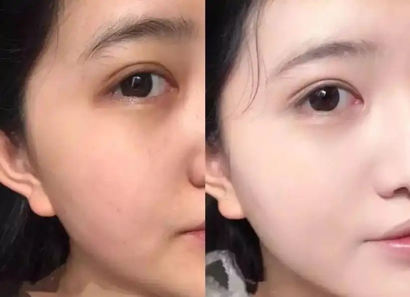 Why Skin Tone Comparison is Pointless – A Dermatologist’s Honest Advice