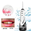 The BPF-01 Water Flosser