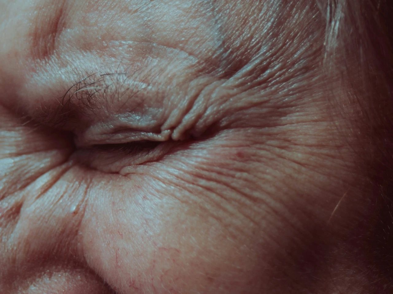 How to Target Skin Aging at Its Core: The Free Radical Balancing Act